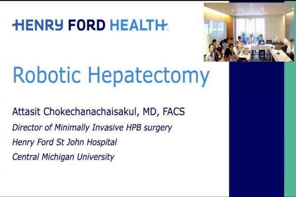 Robotic Hepatectomy