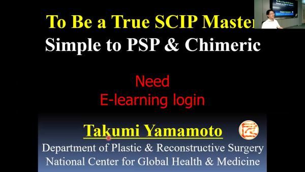SCIP flap