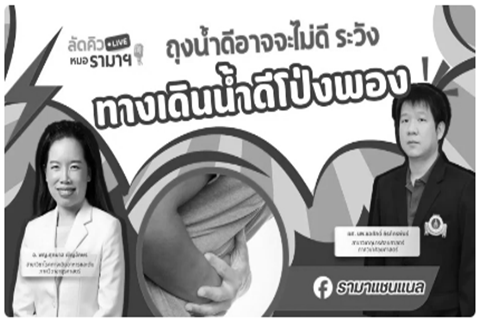 ถุงน้ำดีอาจจะไม่ดี ระวังทางเดินน้ำดีโป่งพอง