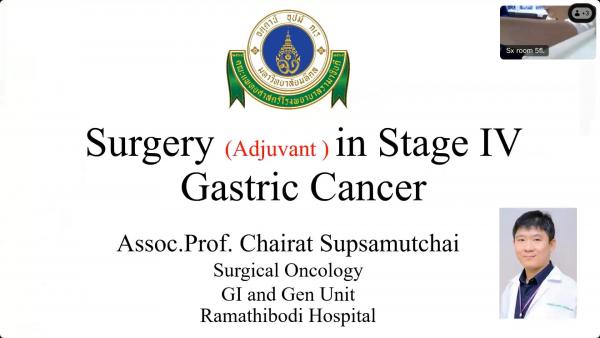 Stage IV Gastric Cancer