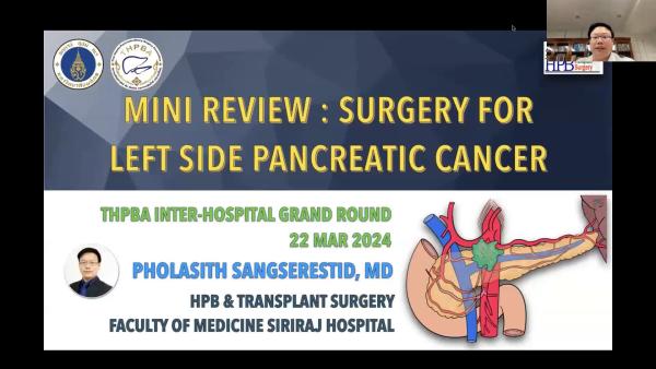 Surgery for Left side Pancreatic Cancer