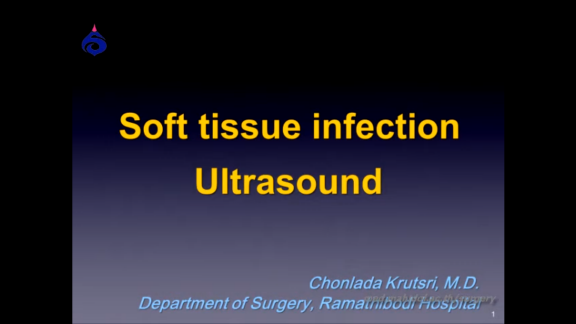 Sofl tissue infection Ultrasound
